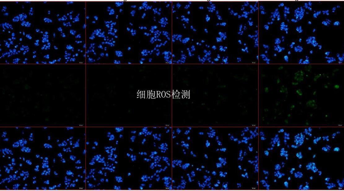 细胞ROS检测
